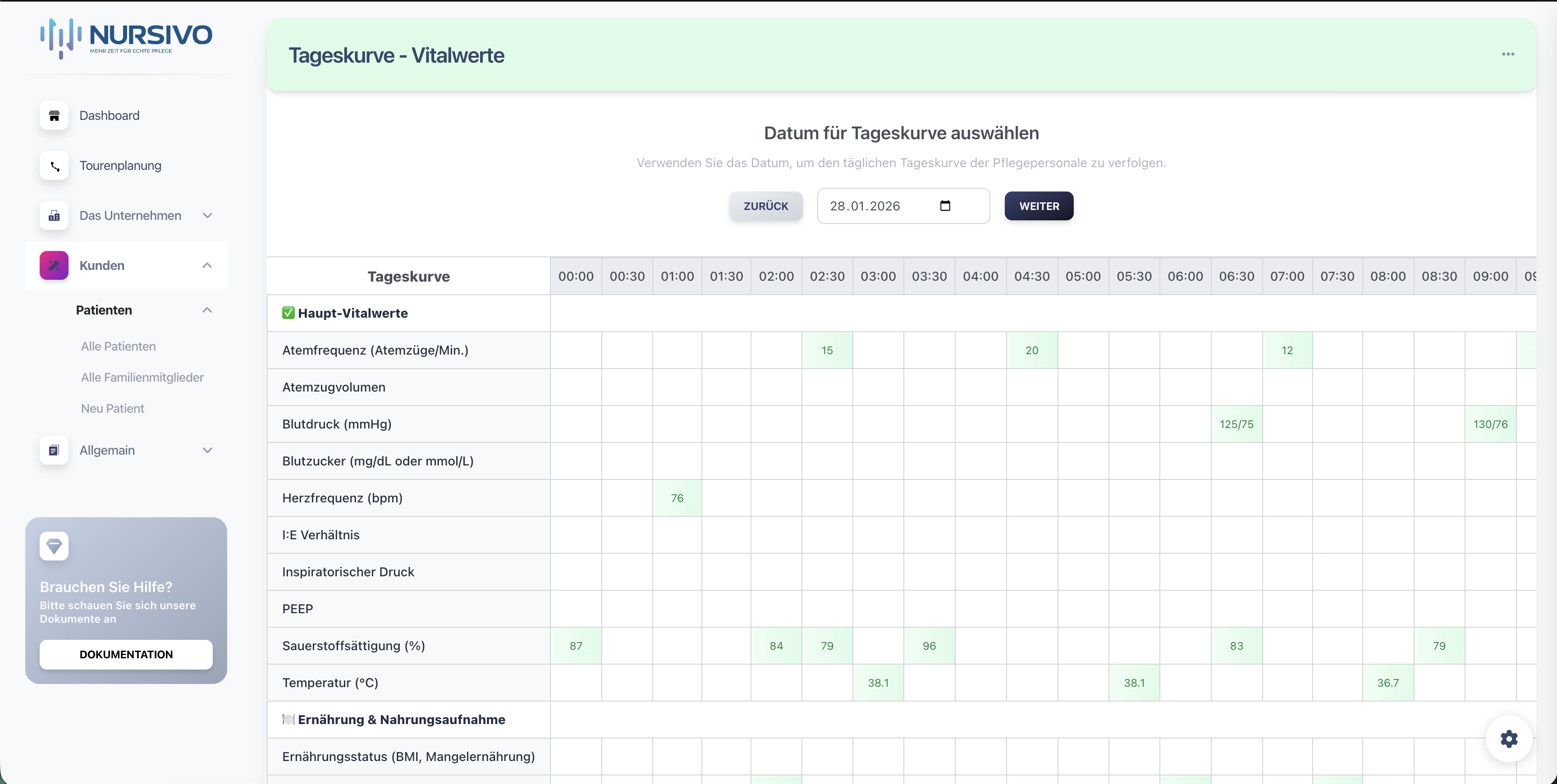 Vitalwerte in der Tageskurve auf Desktop